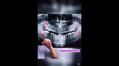 WISDOM TEETH What Teeth Reveal About Your Health. Each tooth in the human mouth is related