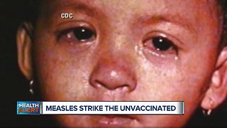 Measles outbreak grows in area with low vaccination rate, most patients unimmunized