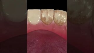Dental health short videos