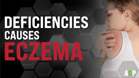 Deficiencies Causes Eczema