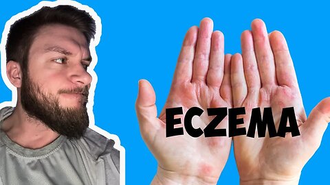 Getting Eczema in the Winter Time
