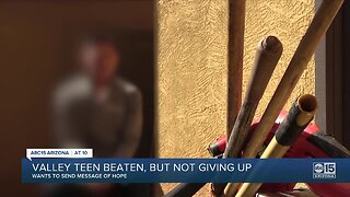 Valley teen teaches life lesson after being beaten