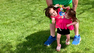 Miracle Conjoined Twins Learning To Walk | BORN DIFFERENT