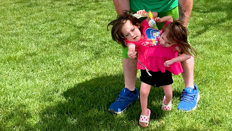 Miracle Conjoined Twins Learning To Walk | BORN DIFFERENT