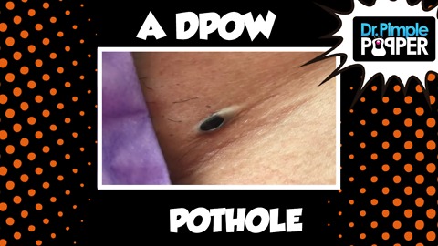A Little DPOW Pothole