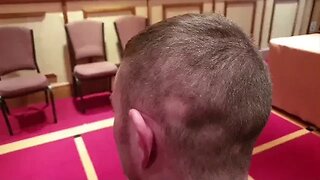 Alopecia Treatment / Result