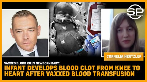 Vaxxed Blood KILLS Baby Infant Develops Blood Clot From Knee To Heart After Vaxxed Blood Transfusion