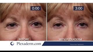 Drastically reduce fine lines and wrinkles on your face