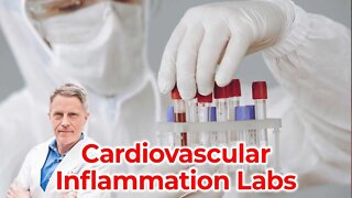 CV Inflammation Labs