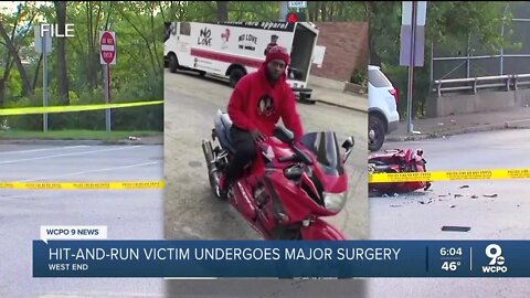 Hit-and-run victim undergoes surgery as police still look for person of interest