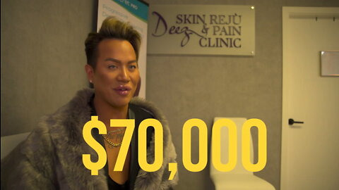 Human Ken Doll Spends $70K Maintaining His Look | BLING LIFE