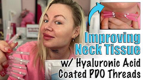 Improving my Neck Tissue with HA Coated PDO threads, AceCosm | Code Jessica10 saves you money