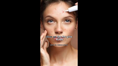 how to remove acne #glowuptips #beautytips #modeltips #modelsecerts #securm #whitiningserum