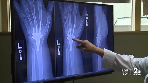 Relieving arthritis pain through surgery