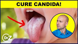 How To Treat Candida In 6 Steps | Dr. Nick Z.