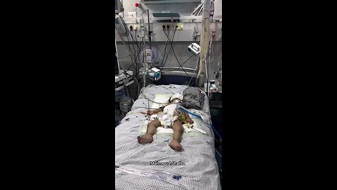 🔴 مستشفى كمال عدوان تحذر من استشهاد الجرحى والأطفال جراء نفاذ الوقود وتوقف مولدات المستشفى