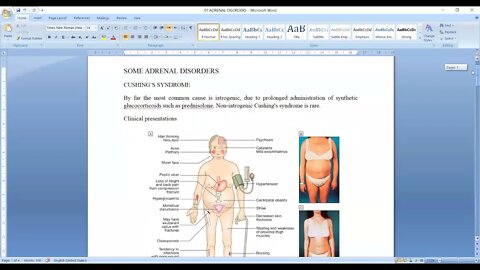 General medicine L16 (Adrenal disorders)