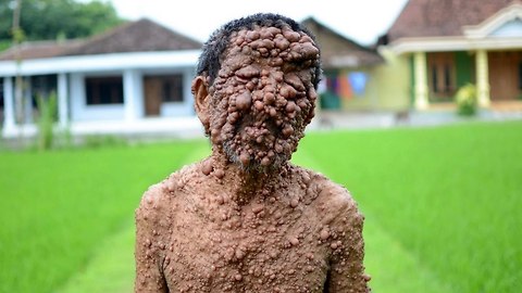 10 Diseases That Could Wipe Out Humanity