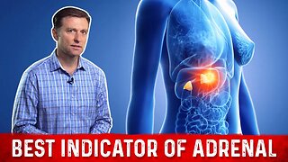 Dr.Berg Unfolds the Biggest Symptom of Adrenal Fatigue