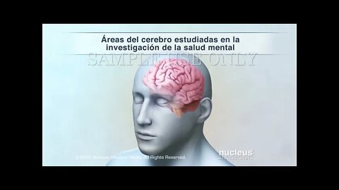 El cerebro y la salud mental
