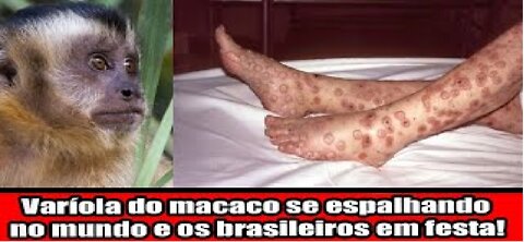 Varíola do macaco se espalhando no mundo e os brasileiros em festa