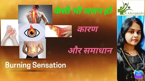 Burning sensation || कैसी भी जलन || causes & treatment #burningsensation