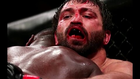 TOP 5 HORRIBLE JAW INJURIES IN THE UFC!