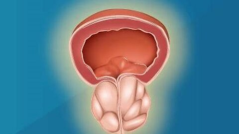 NATURAL REMEDIES FOR AN ENLARGED PROSTATE