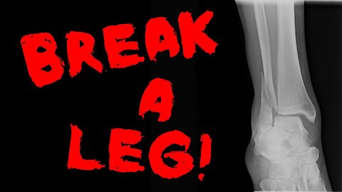 They say "Break a leg!"... so I did.