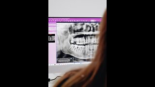 Expensive CAT Scans And Implant Materials When Selling A Dental Practice