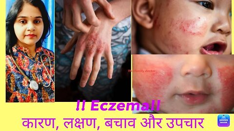 Eczema|खुजली के कारण और होम्योपैथिक उपचार