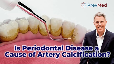 Is periodontal disease a cause of artery calcification?