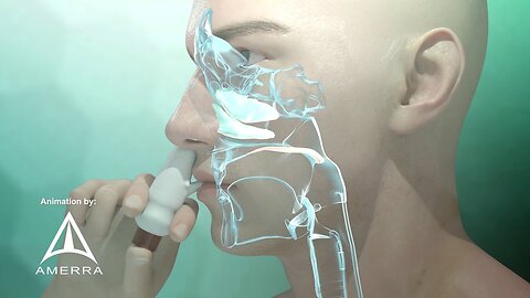 Fluticasone nasal spray (Flonase) - 3D medical animation