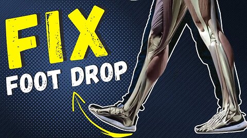 How To fix foot drop at home