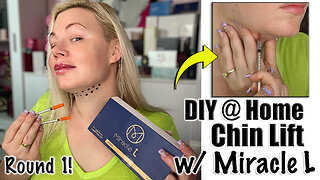 DIY Chin Lift with Miracle L: Round 1 from Acecosm.com | Code Jessica10 Saves you Money!