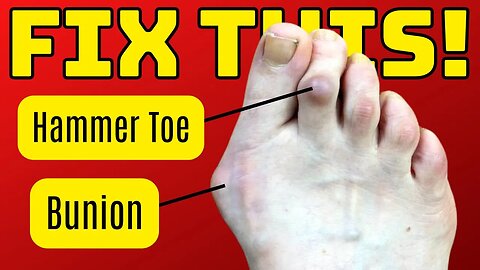 Top 3 Fixes For Foot Pain