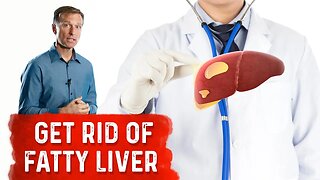 Reduce Your Liver Fat by 50 Percent in 14 Days