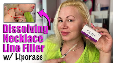 Dissolving Necklace Line Filler with Liporase from AceCosm.com | Code Jessica10 Saves you Money!