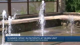 Summer Spike in Patients at Burn Unit