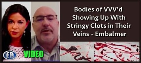 EMBALMERS FIND VEINS AND ARTERIES FILLED WITH NEVER BEFORE SEEN RUBBERY CLOTS