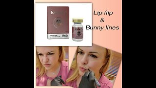 Lip Flip, Bunny Lines / Chin Enhancement 2021