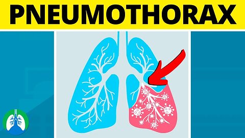 Pneumothorax (Medical Definition) | Quick Explainer Video