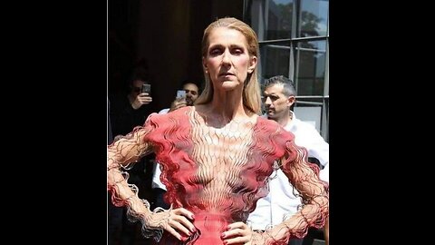 Celine Dion: Stiff Person Syndrome, or Kuru?