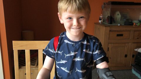 Kid tests out new 3D printed robot arm