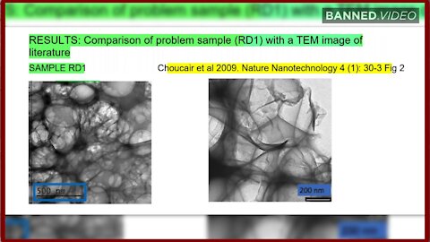 WARNING: Toxic Nano-particles Used To Amplify mRNA In COVID Vaccine - 2335