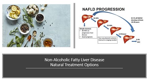 Non Alcoholic Fatty Liver Disease - Natural Treatment