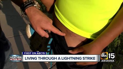 El Mirage teen struck by lightning speaks out