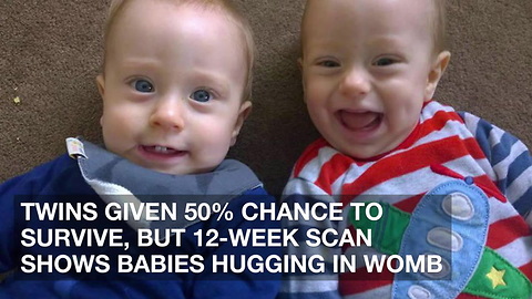 Twins Given 50% Chance to Survive, But 12-Week Scan Shows Babies Hugging in Womb