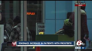 Hospital seeing an increase in patients with frostbite