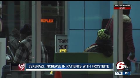 Hospital seeing an increase in patients with frostbite